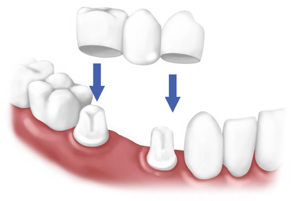 Dentalsancak A��z ve Di� Sa�l��� Poliklini�i